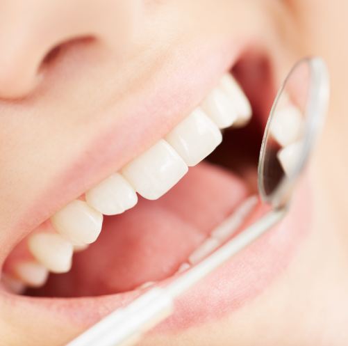 Retaining Smile